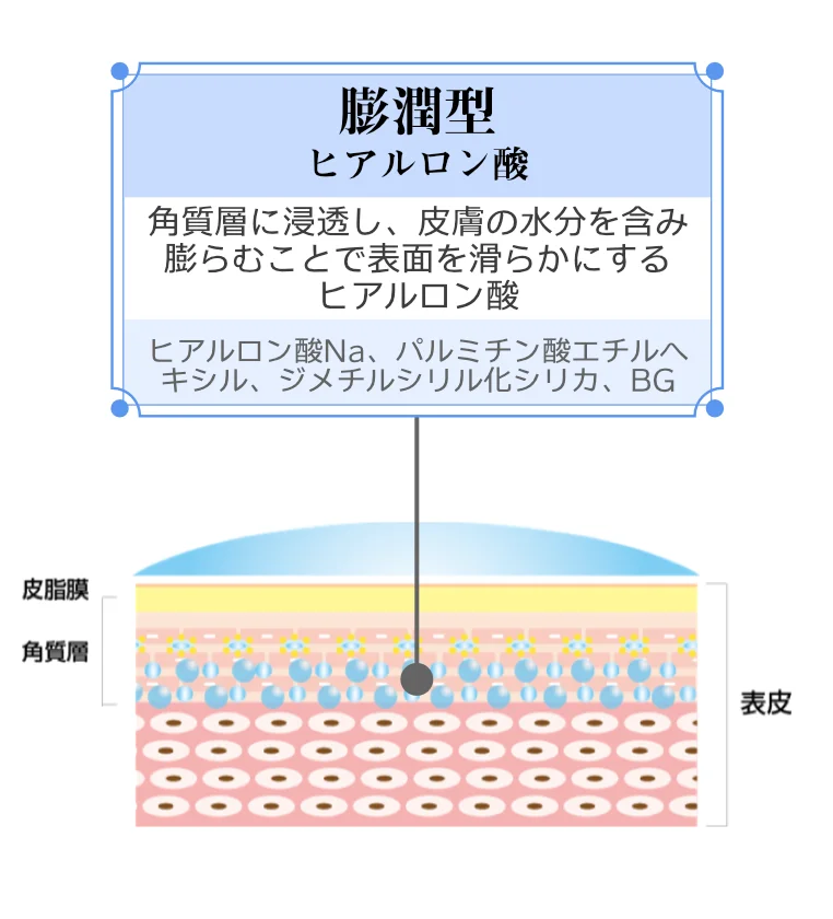膨潤型ヒアルロン酸